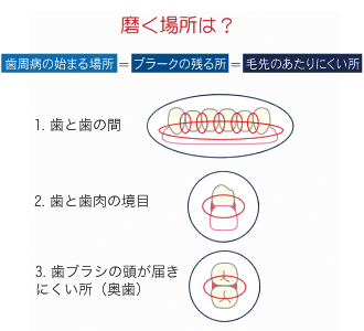 ブラッシング