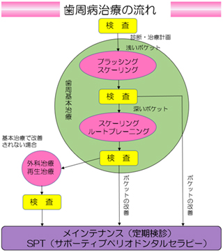 歯周病治療の流れ