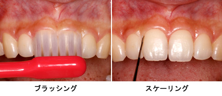 基本治療