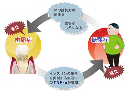 日本臨床歯周病学会 歯周病が全身に及ぼす影響